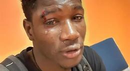 "Negro di m...". Senegalese circondato e pestato a sangue a Palermo