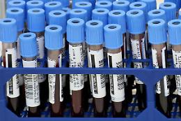 Un morto e 1.444 nuovi casi. Il bollettino del 29 agosto