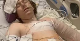 Usa, polizia spara ad un 13enne affetto da sindrome di Asperger: &egrave; grave