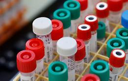 Covid, numeri in leggero calo: 20.648 i nuovi casi e 541 vittime