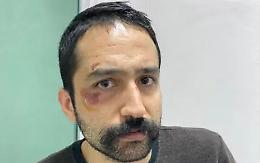 Turchia, arrestato e picchiato l&rsquo;avvocato Ayta&ccedil; &Uuml;nsal. Il ministero: &laquo;Tentava la fuga&raquo;