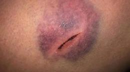 Santa Maria Capua Vetere, il Garante contro la gogna per gli agenti indagati