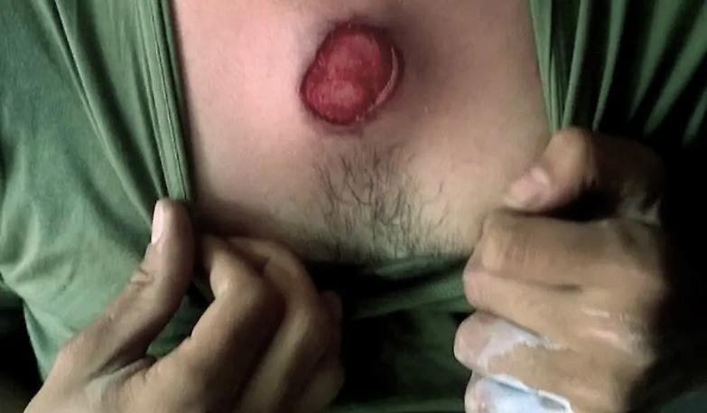 Polizia francese sotto accusa per il micidiale "flash-ball"