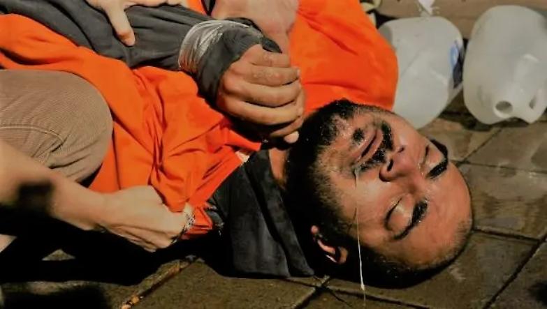 Bentornata signora Tortura...