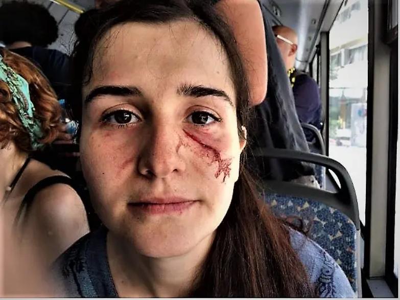 Erdogan non si ferma: pestaggi e manette ai difensori dei diritti