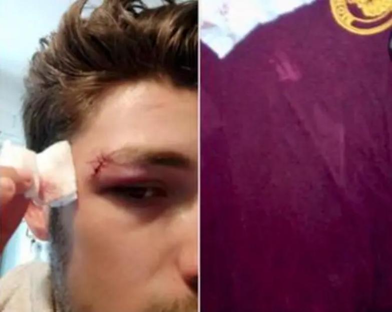 Aggrediti perch&eacute; indossano una maglietta antifascista