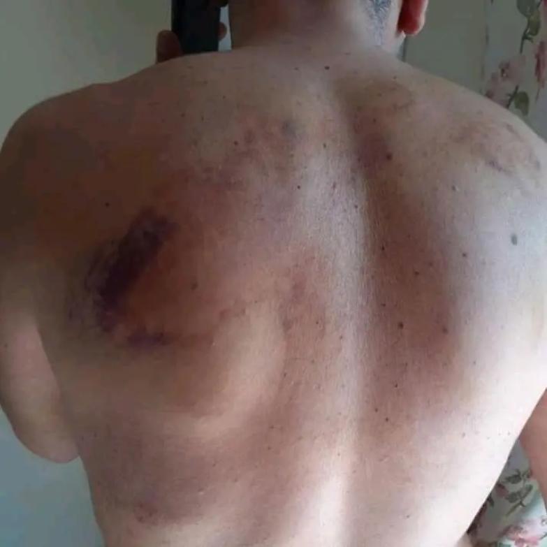 &laquo;Detenuti picchiati in carcere da 300 agenti a volto coperto&raquo;