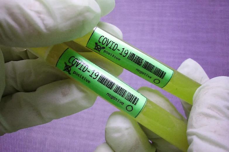 Contagi ancora in aumento: 4.458 nuovi casi su oltre 120mila tamponi. Picco in Campania e Lombardia