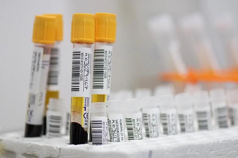 Covid, il bollettino di oggi: 18.887 nuovi casi e 564 morti