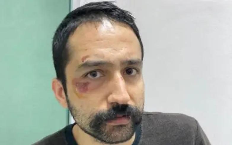 Turchia, arrestato e picchiato l&rsquo;avvocato Ayta&ccedil; &Uuml;nsal. Il ministero: &laquo;Tentava la fuga&raquo;