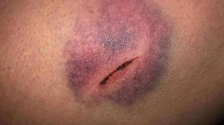 Il degrado in cella pu&ograve; causare altri pestaggi rivolte e suicidi