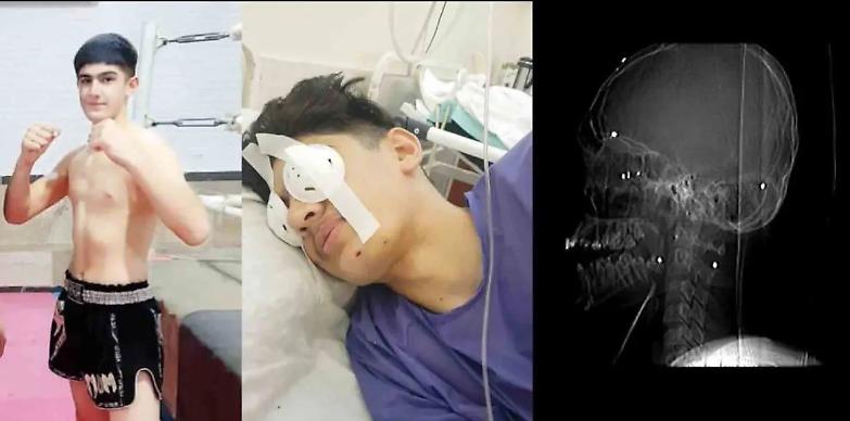 L&rsquo;appello per curare Zaniar Tondro, colpito alla testa dal regime iraniano