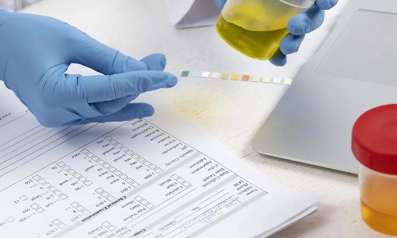 Test antidroga obbligatori per parlamentari e magistrati: la proposta di legge di Saverio Romano